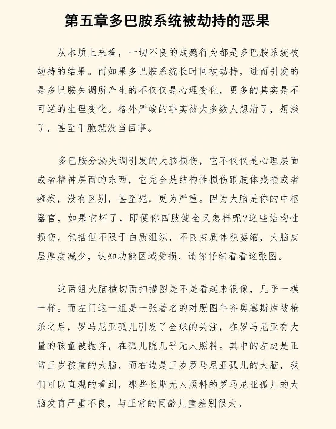 大脑横切面扫描对照